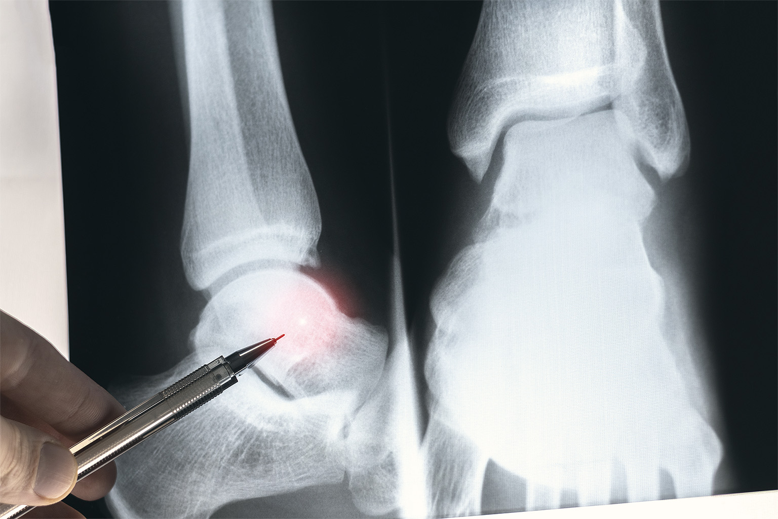 Doctor studying ankle X-ray