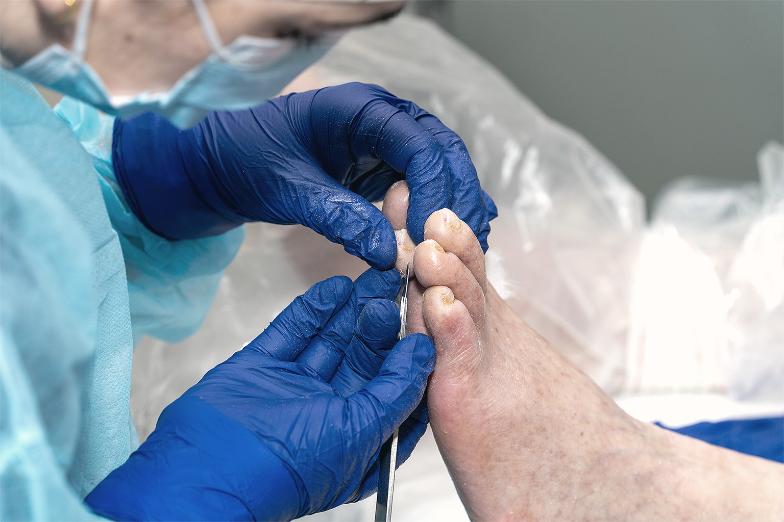 Podiatrist treating toenails